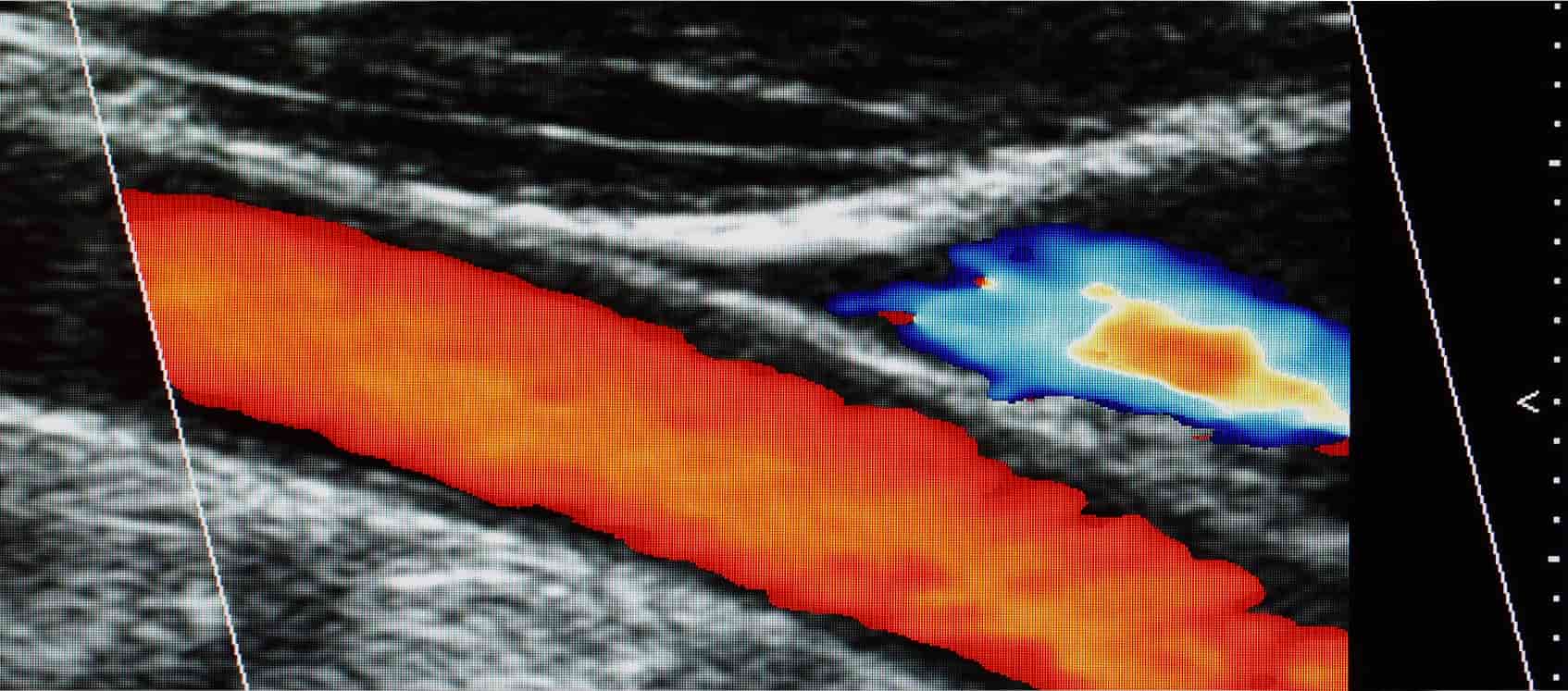 Ultrasonido Especializado Doppler